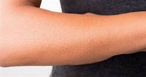 giai-ma-hien-tuong-noi-da-ga-la-diem-gi-tot-hay-xau-58